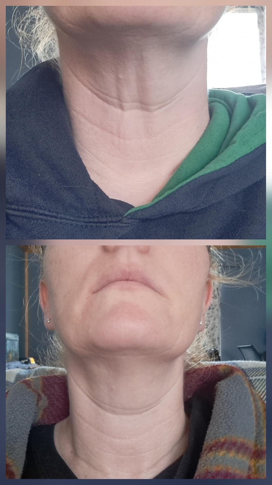 Gold Bond Age Renew Neck & Chest Firming Age Renew Cream, 2 oz., Clinically Tested Skin Firming Cream customer photo 1