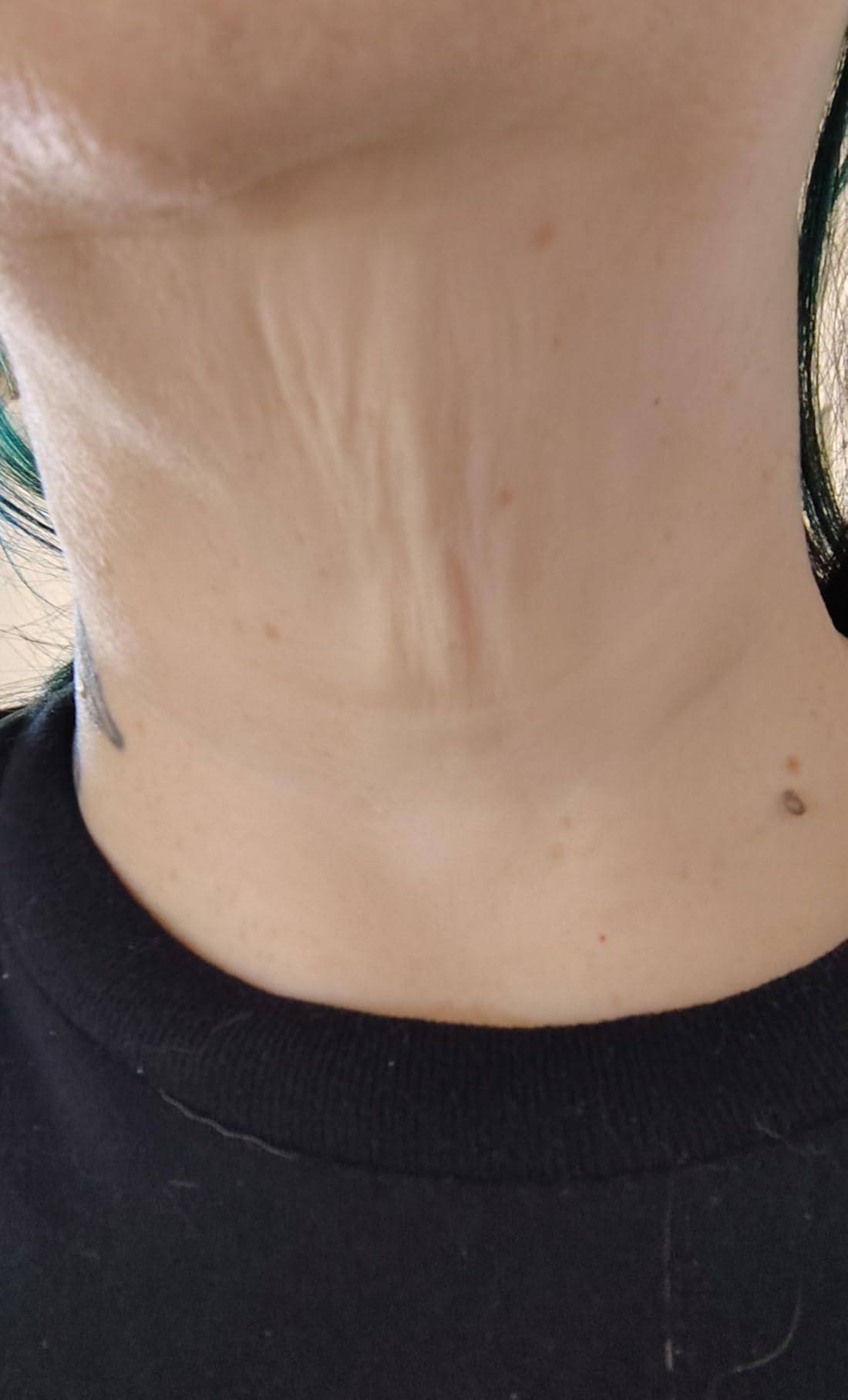 MAREE V Line Lifting Mask with 24K Gold - Deep Collagen Face Mask for Women - Jawline Shaper Mask with Retinol & Hyaluronic Acid - Neck Tightening & Firming - Double Chin Strap for Face Lift customer photo 2