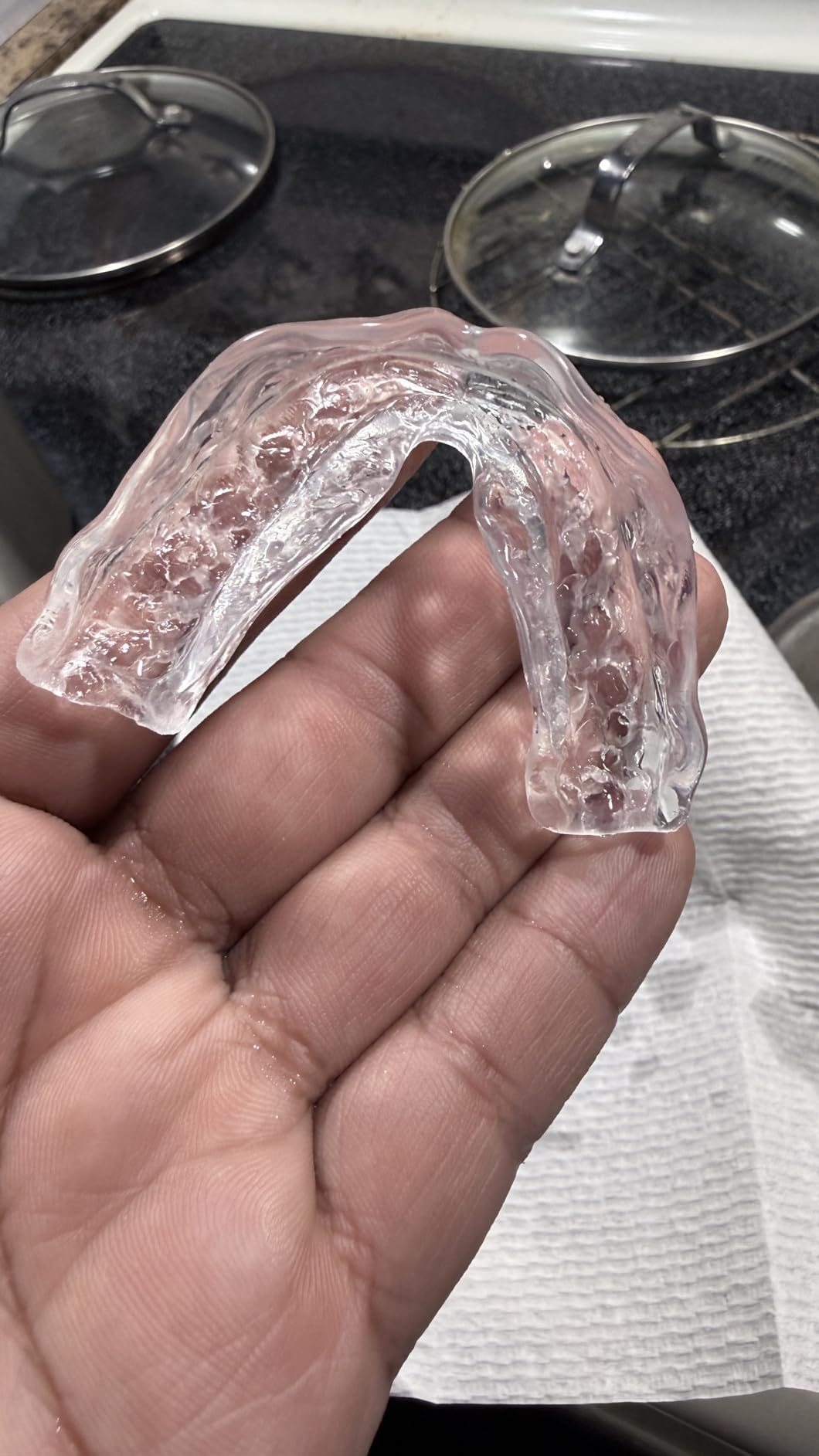 HONEYBULL Anti Grinding Guard Set, Comes in 2 Sizes for Light and Heavy Grinding, Comfortable Custom Mouth Guard for Nighttime Teeth Grinding (6 Pack - Mixed) customer photo 1
