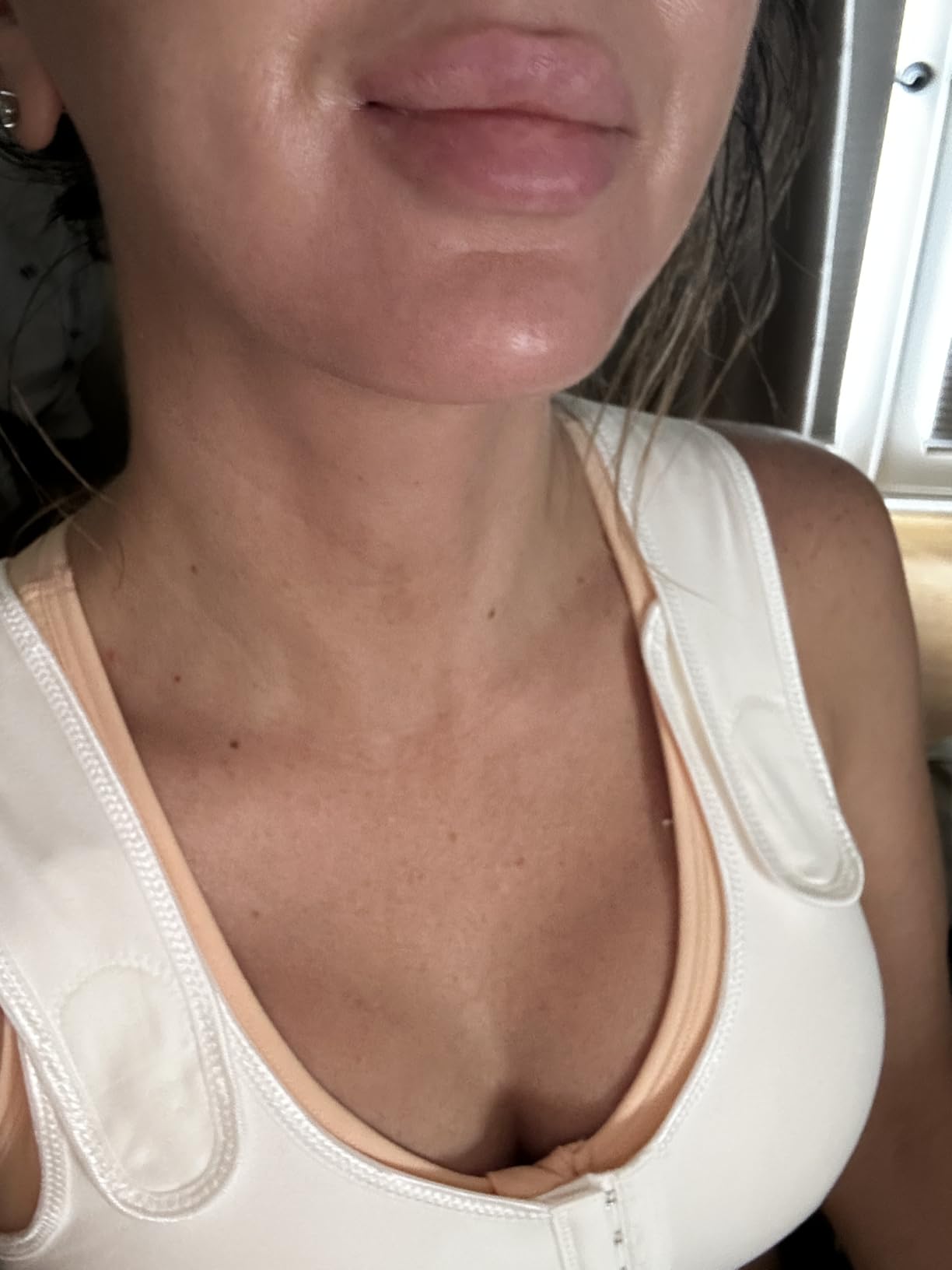 Post Surgery Compression Bras for Women Front Closure Mastectomy Bra with Wide Adjustable Straps Wirefree customer photo 1