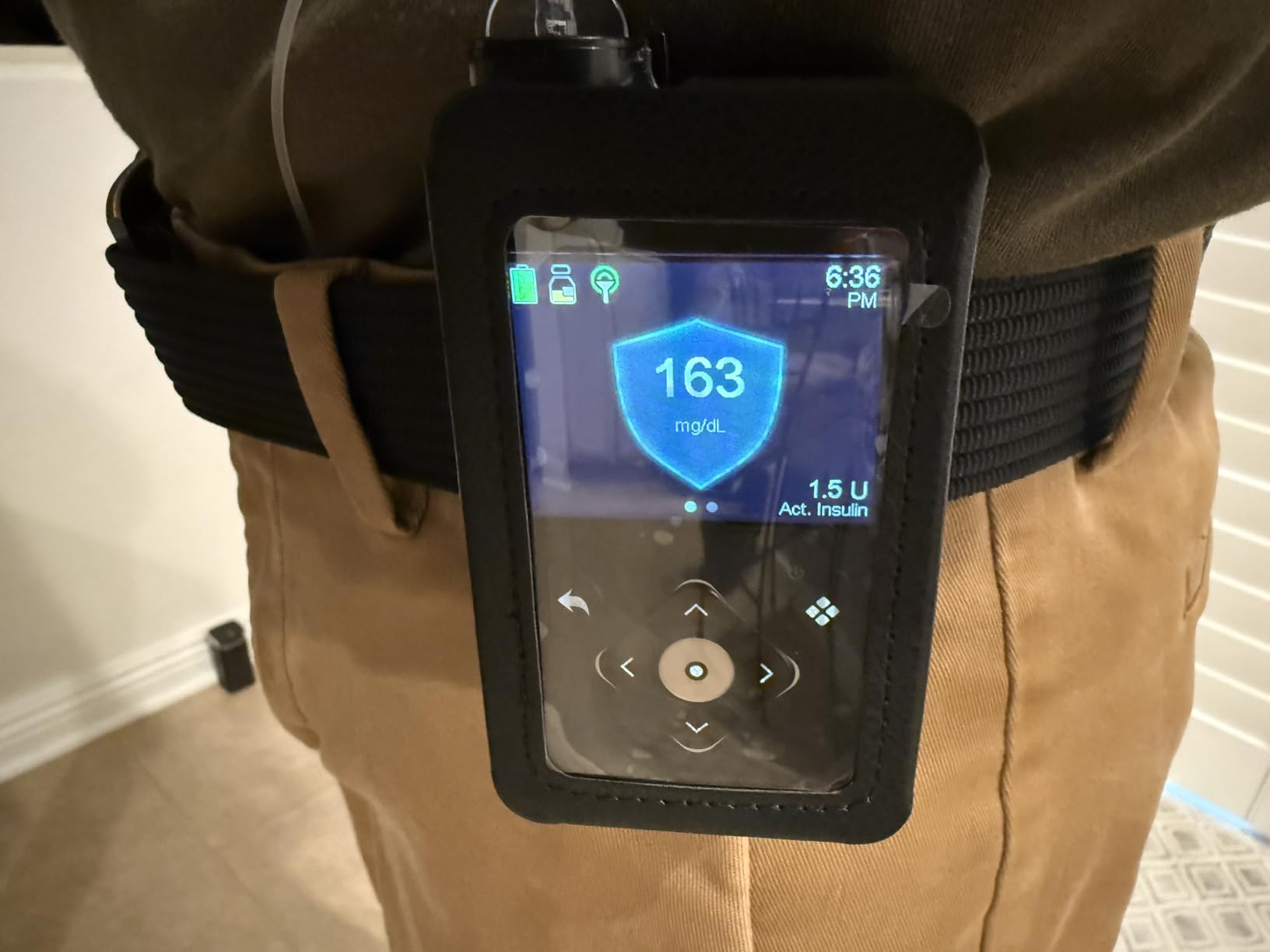 Case for Medtronic MiniMed 780G 770G 670G 630G 640G Insulin Pump, Form-Fit Cover with Screen Protection customer photo 1