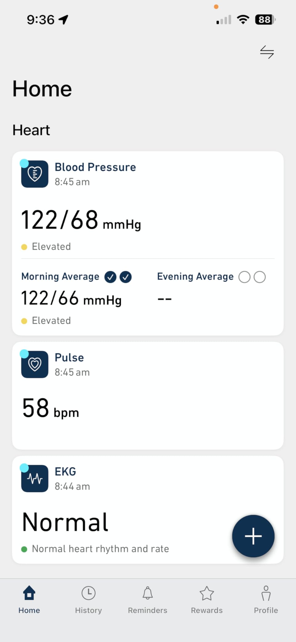 OMRON Complete 2-in-1 Blood Pressure Monitor + EKG for Home Use & Upper Arm Blood Pressure Cuff - #1 Doctor & Pharmacist Recommended Brand - Clinically Validated - Connect App customer photo 1