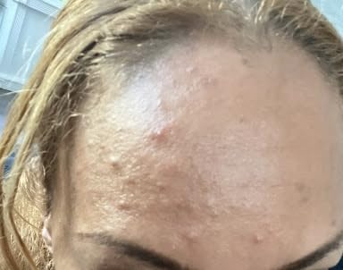 RoC Multi Correxion Revive + Glow Gel Vitamin C Cleanser, Face Wash, Facial Cleanser with Glycolic Acid, Paraben-Free, Sulfate-Free Skin Care - 6 Ounces customer photo 2
