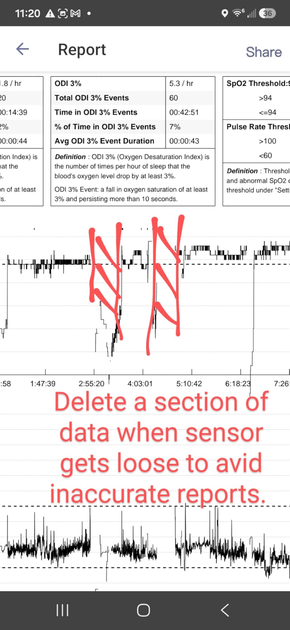 SleepO2 Wrist Recording Pulse Oximeter by EMAY | Continuous Pulse Oximeter to Record Blood Oxygen Saturation and Pulse Rate Overnight | Export Sleep Report & Raw Data customer photo 1
